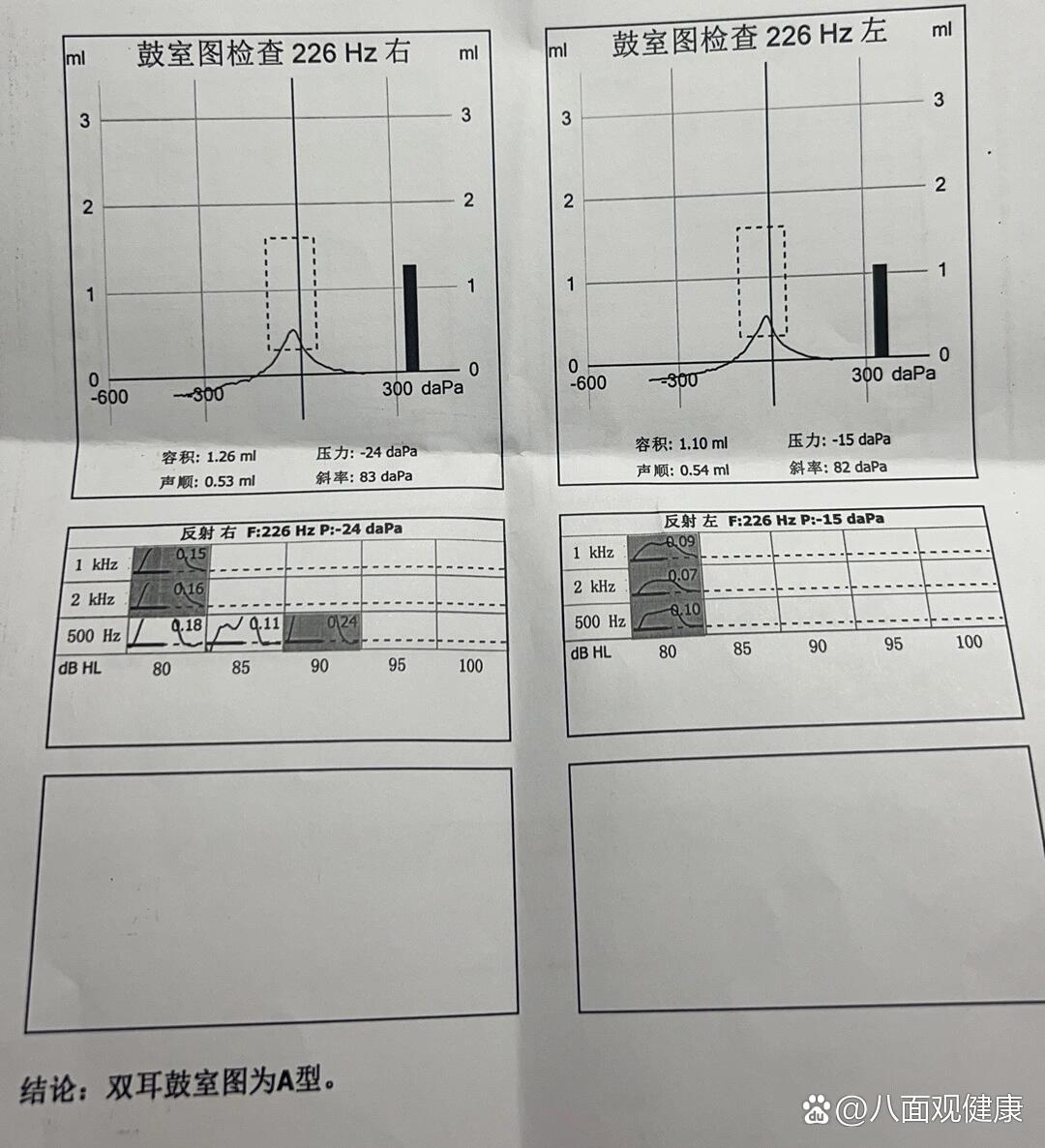 耳朵闷闷的像有层膜一样结果很正常01