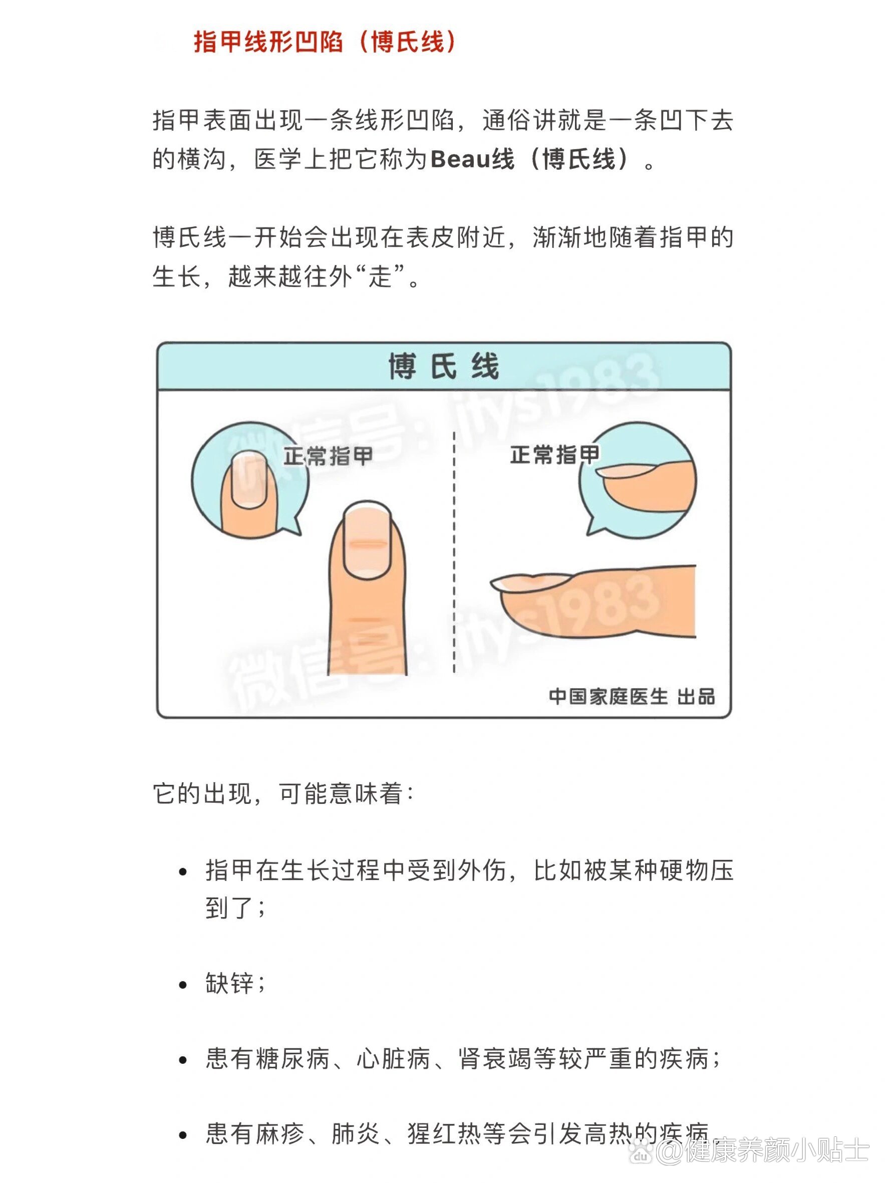 为什么手指甲凹凸不平