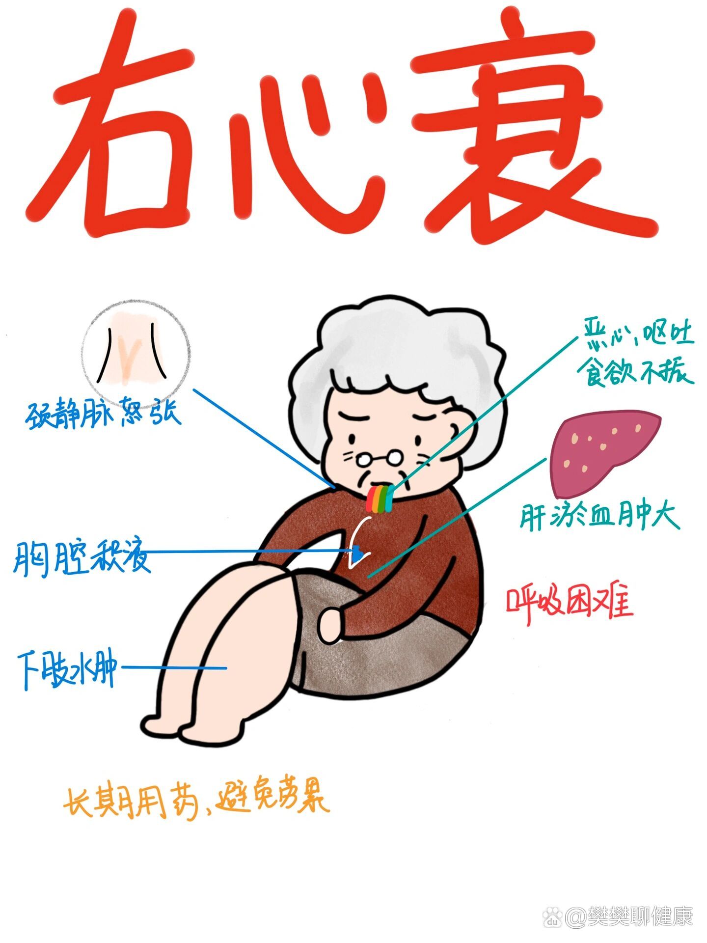 医学生笔记|右心衰