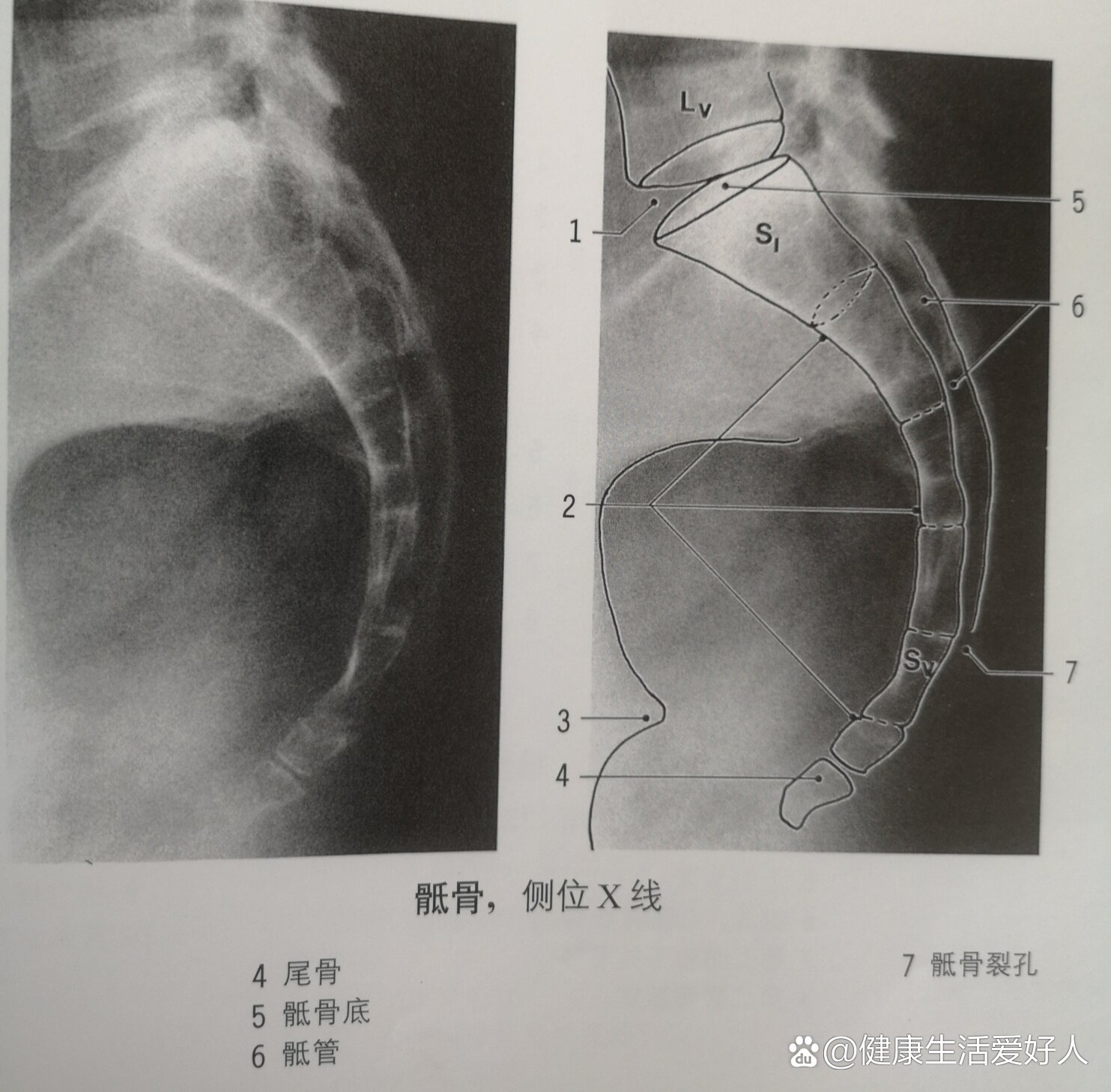 人尾骨的准确位置图片图片