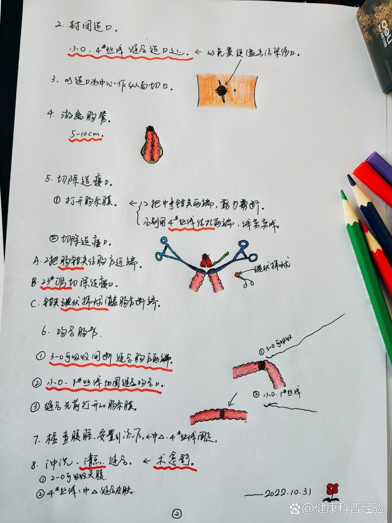 手术配合笔记:造瘘口还纳术.