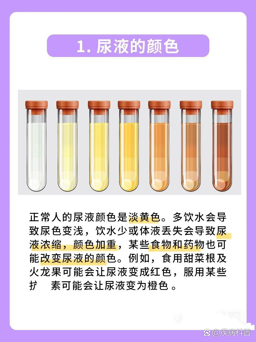 火龙果尿液颜色图片