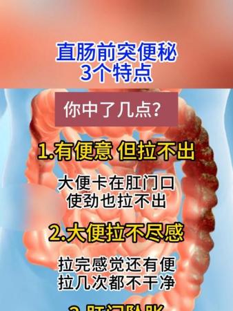 直肠前突最佳治疗方法图片