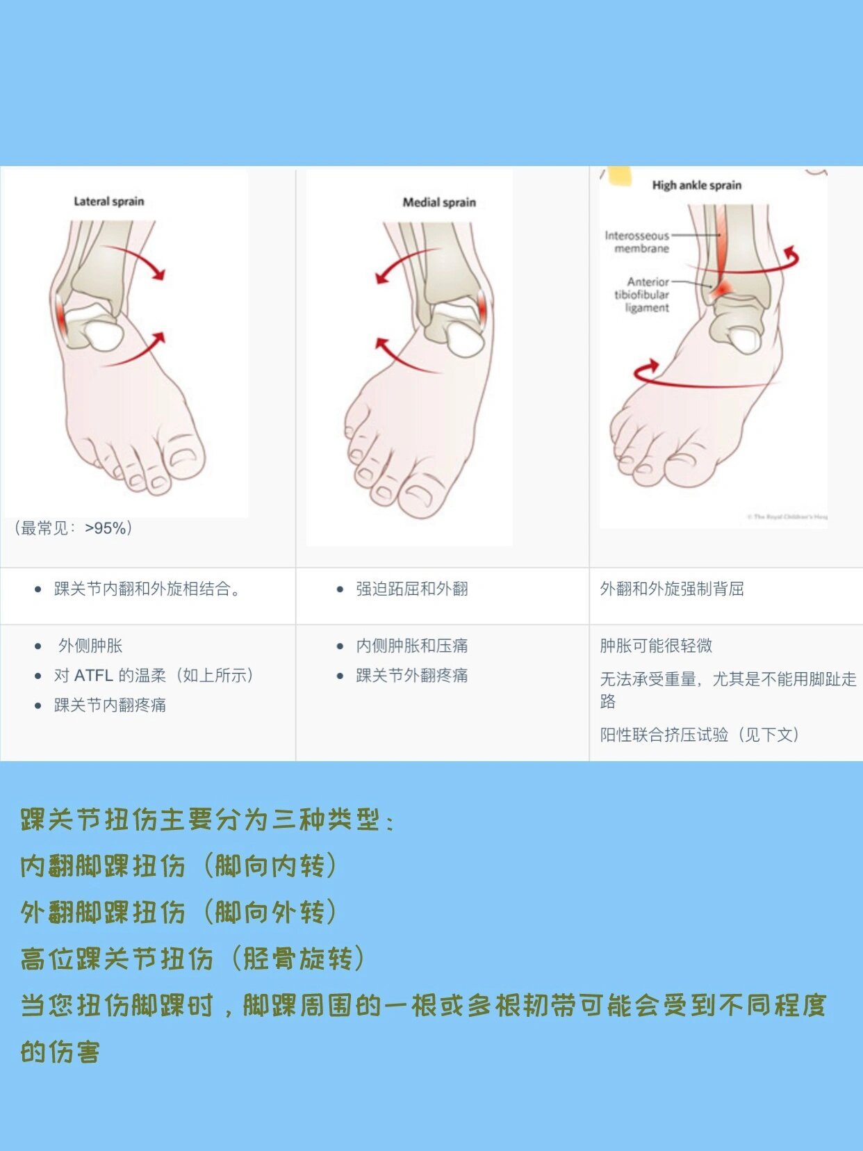 不同级别的踝关节内翻扭伤预计康复时间和要求如下:1 级一1