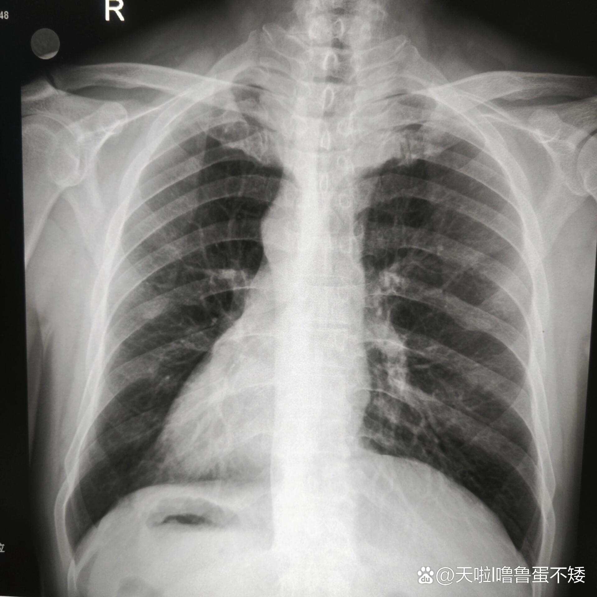 放射科夜班哇哦