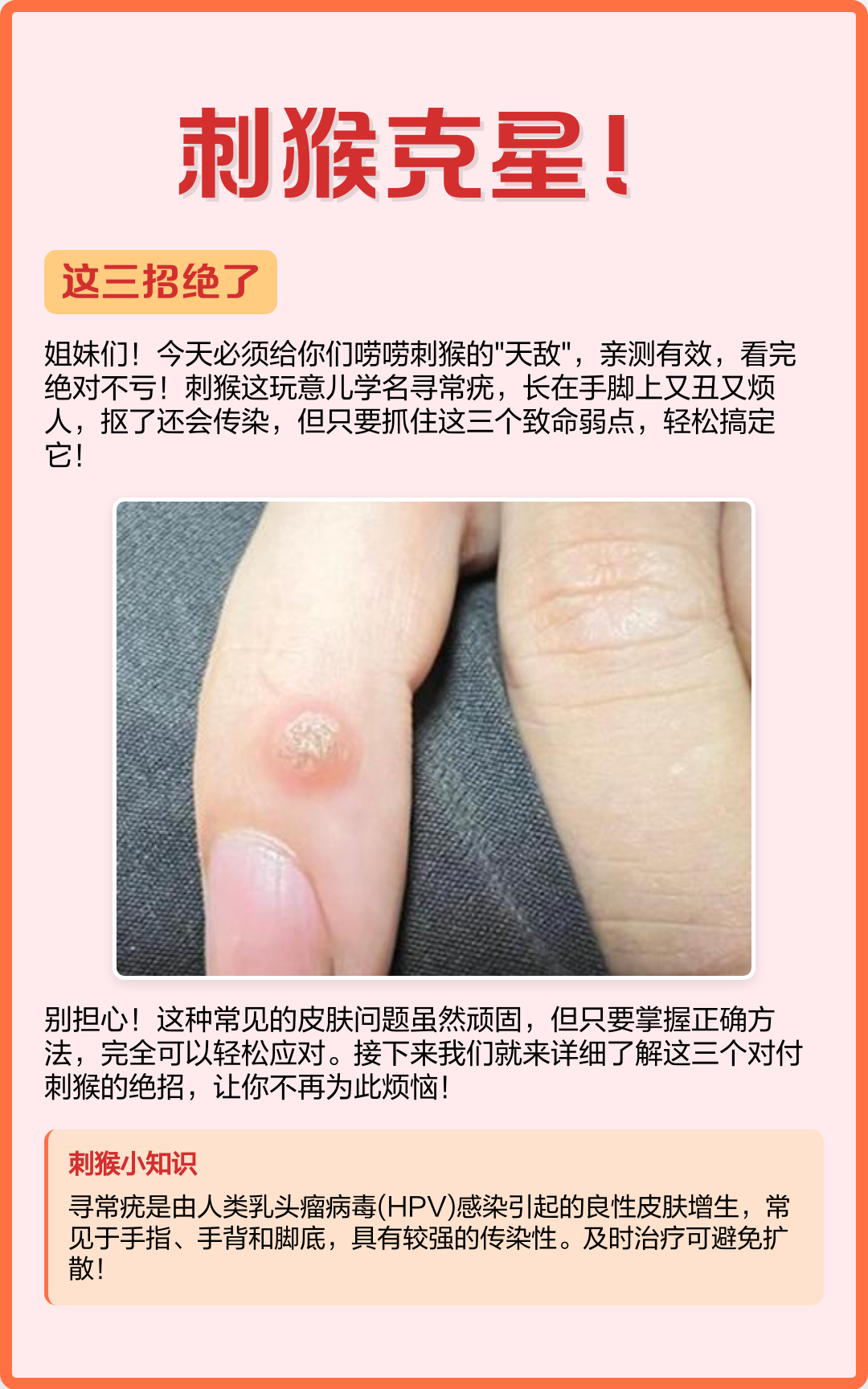 刺猴克星！