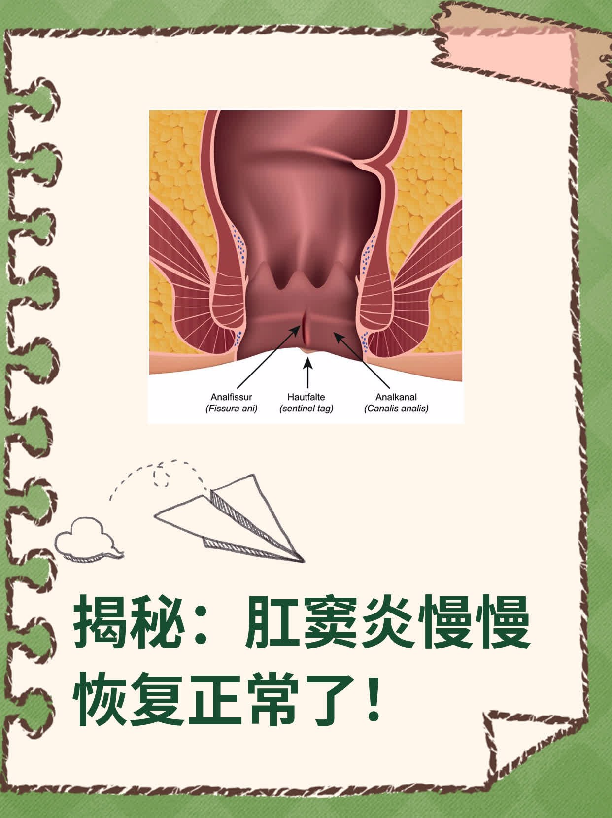 急性肛窦炎图片