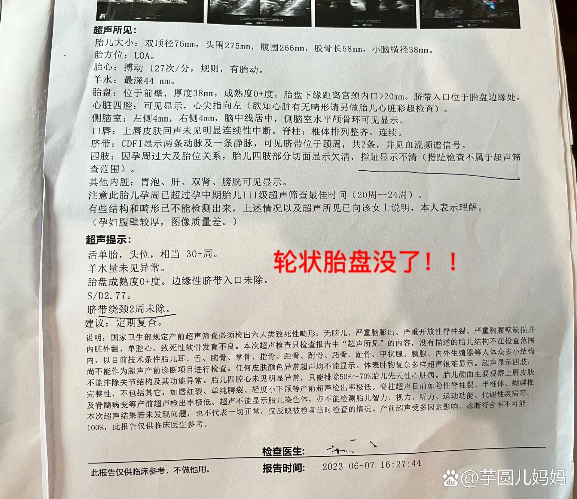 回想起之前照b超被告知轮状胎盘的时候真的很玻璃心,虽然医生说没