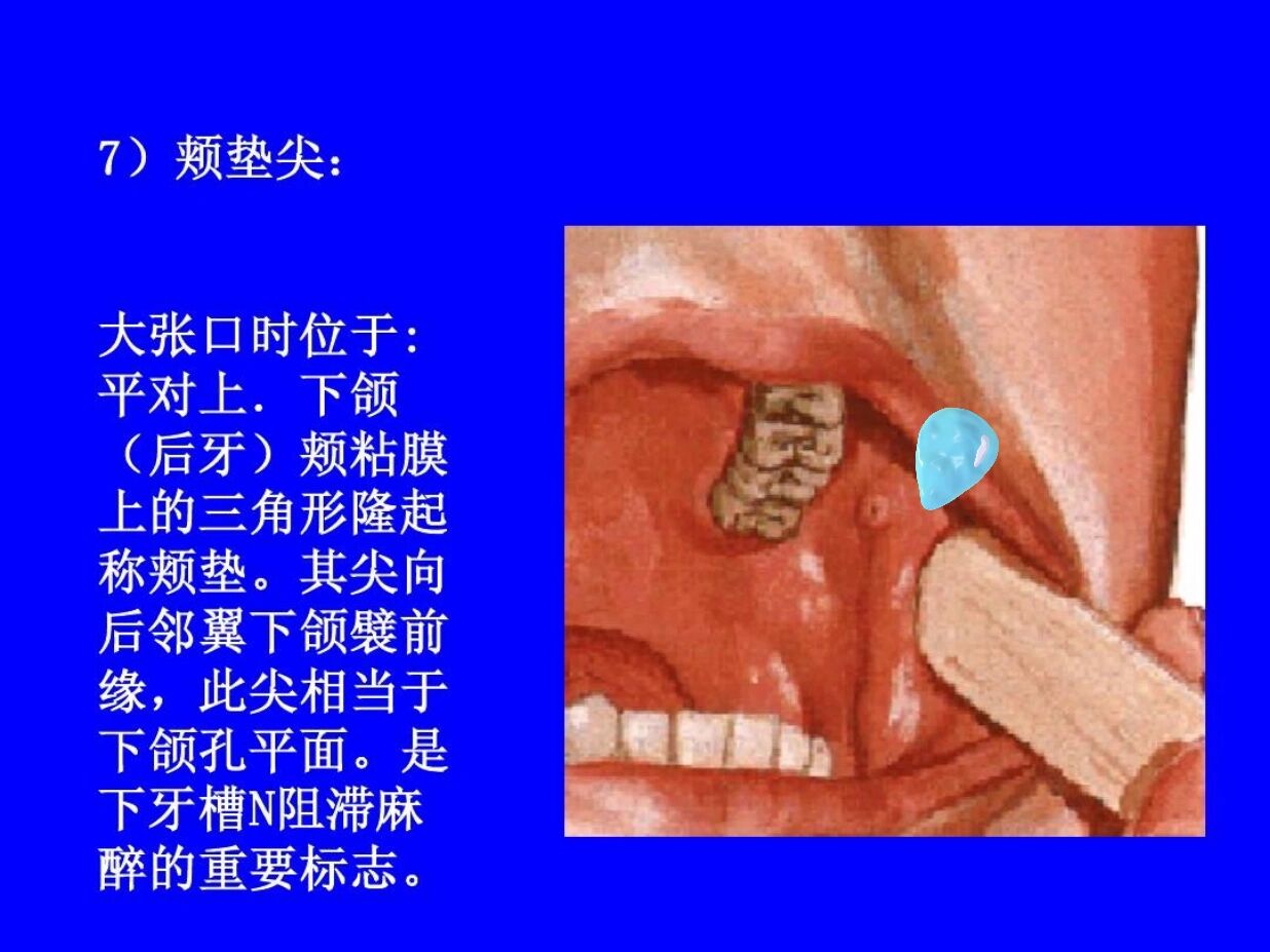 翼下颌皱襞发炎