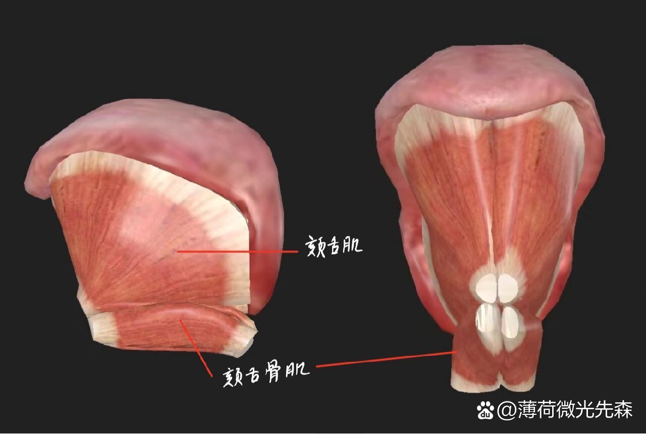 舌肌萎缩图片