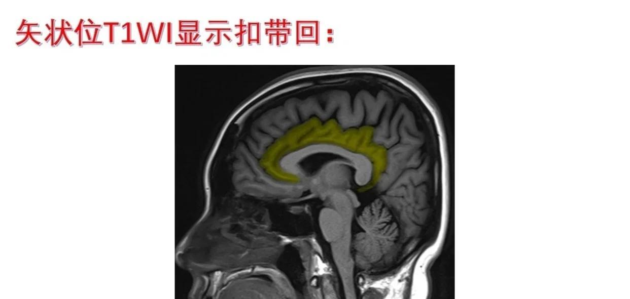 扣带回：大脑边缘系统的核心区域