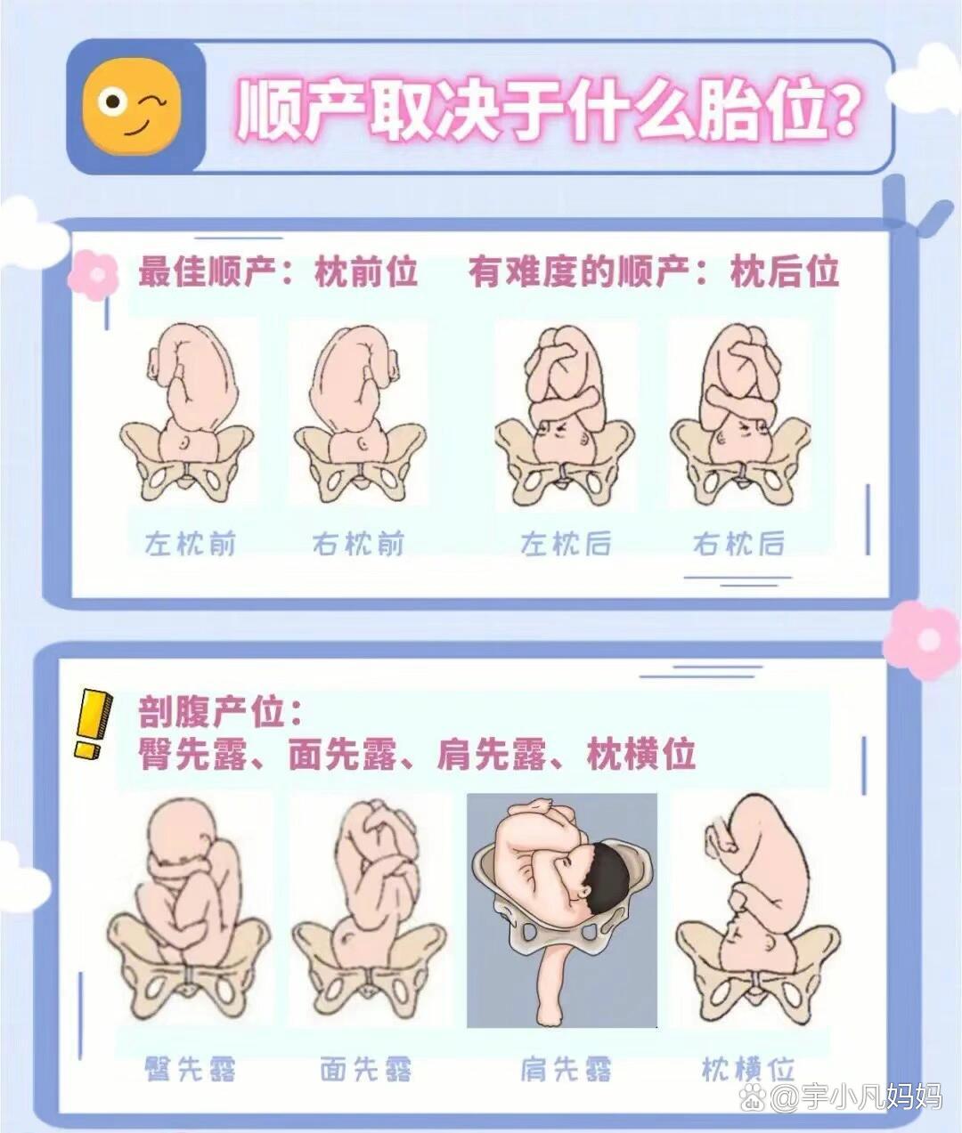 枕后位血泪教训