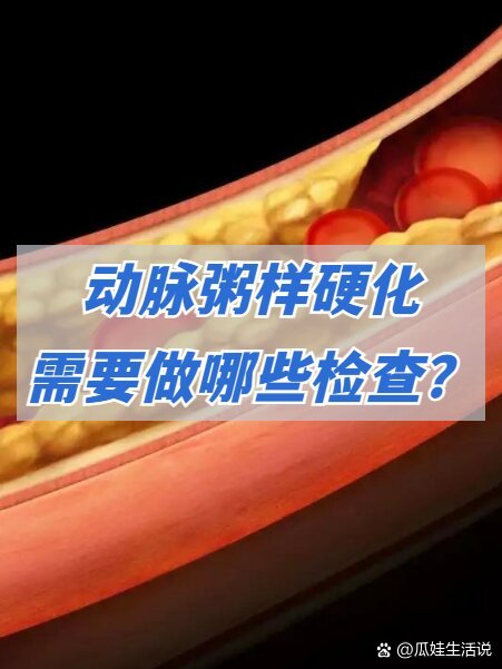 动脉粥样硬化需要做哪些检查?