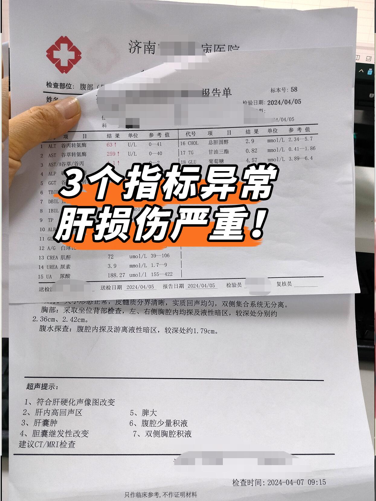 肝功能3个指标异常,肝损伤严重尤其最后一