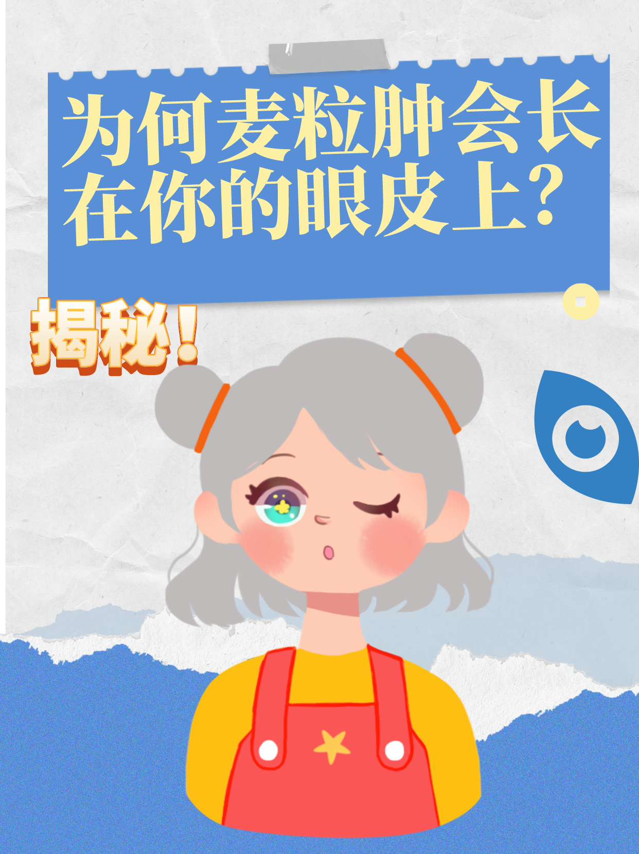 揭秘为何麦粒肿会长在你的眼皮上?