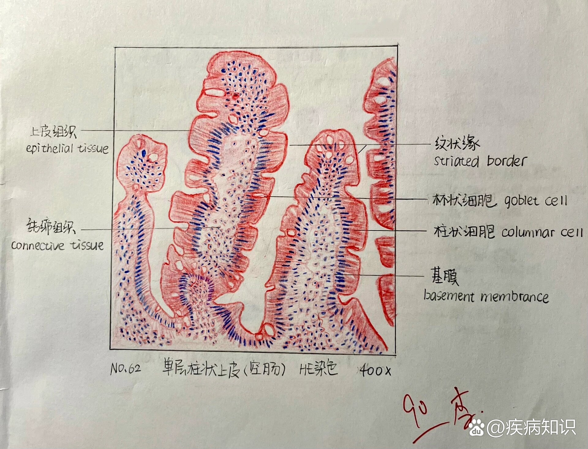 心肌纵断面图片