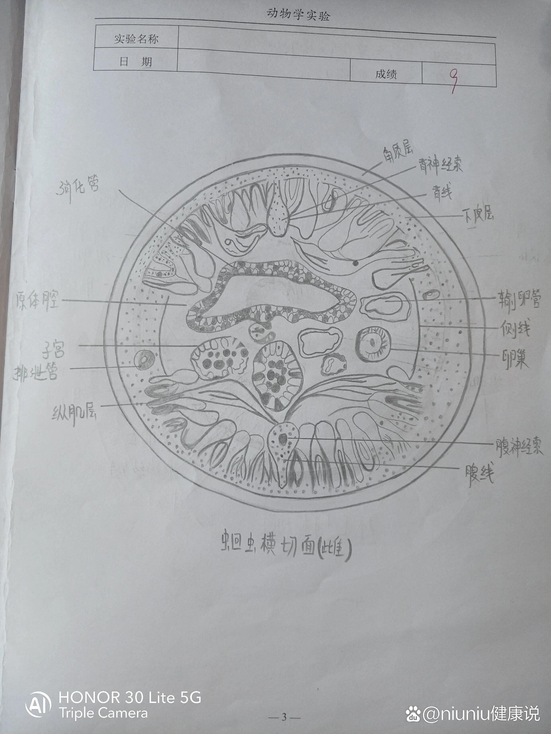 蛔虫的结构简图图片