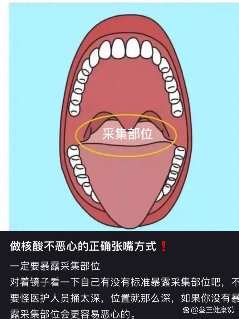 核酸采集咽后壁图片图片