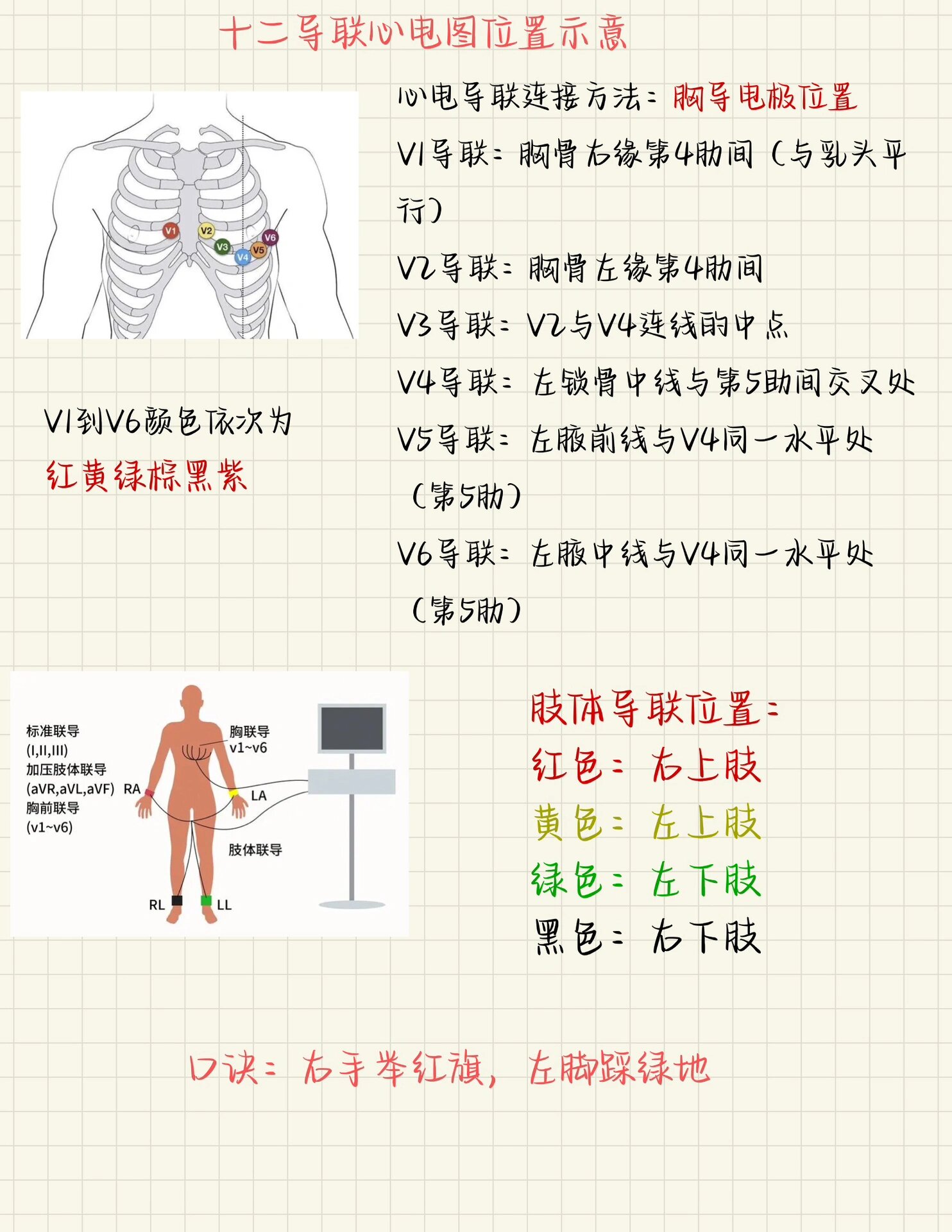 心电图导联位图片