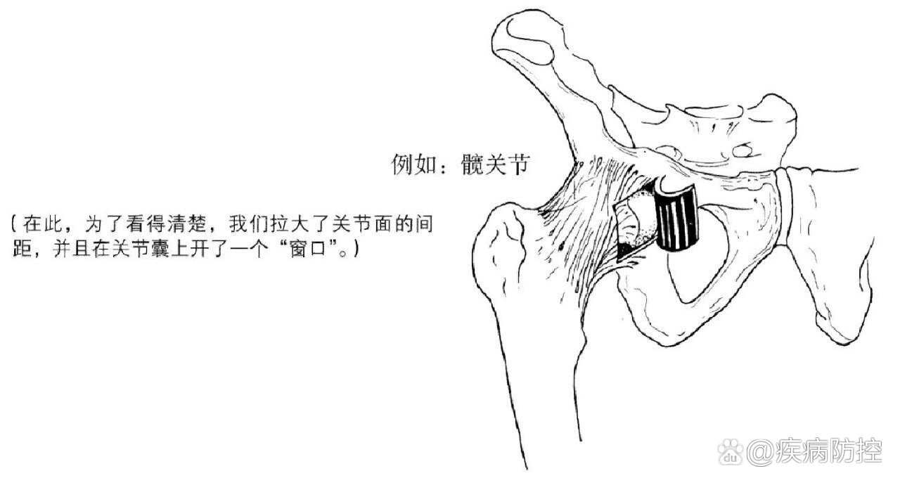 关节囊位置图片