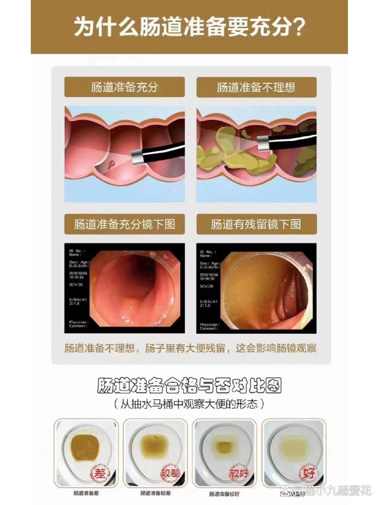 肠镜清肠标准图片