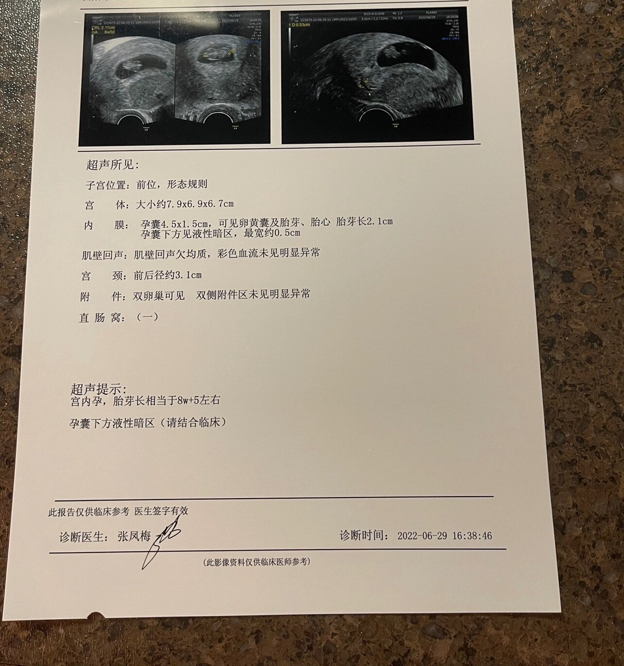 危险的孕8周