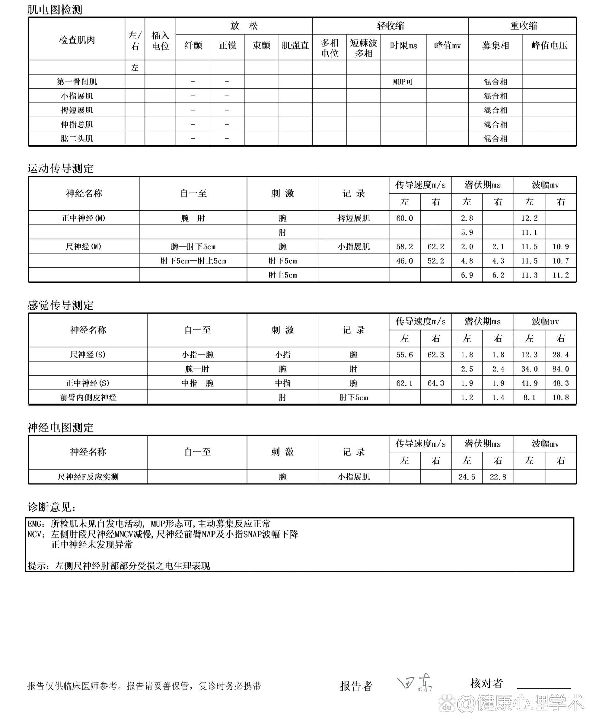 肘管综合征肌电图正常图片