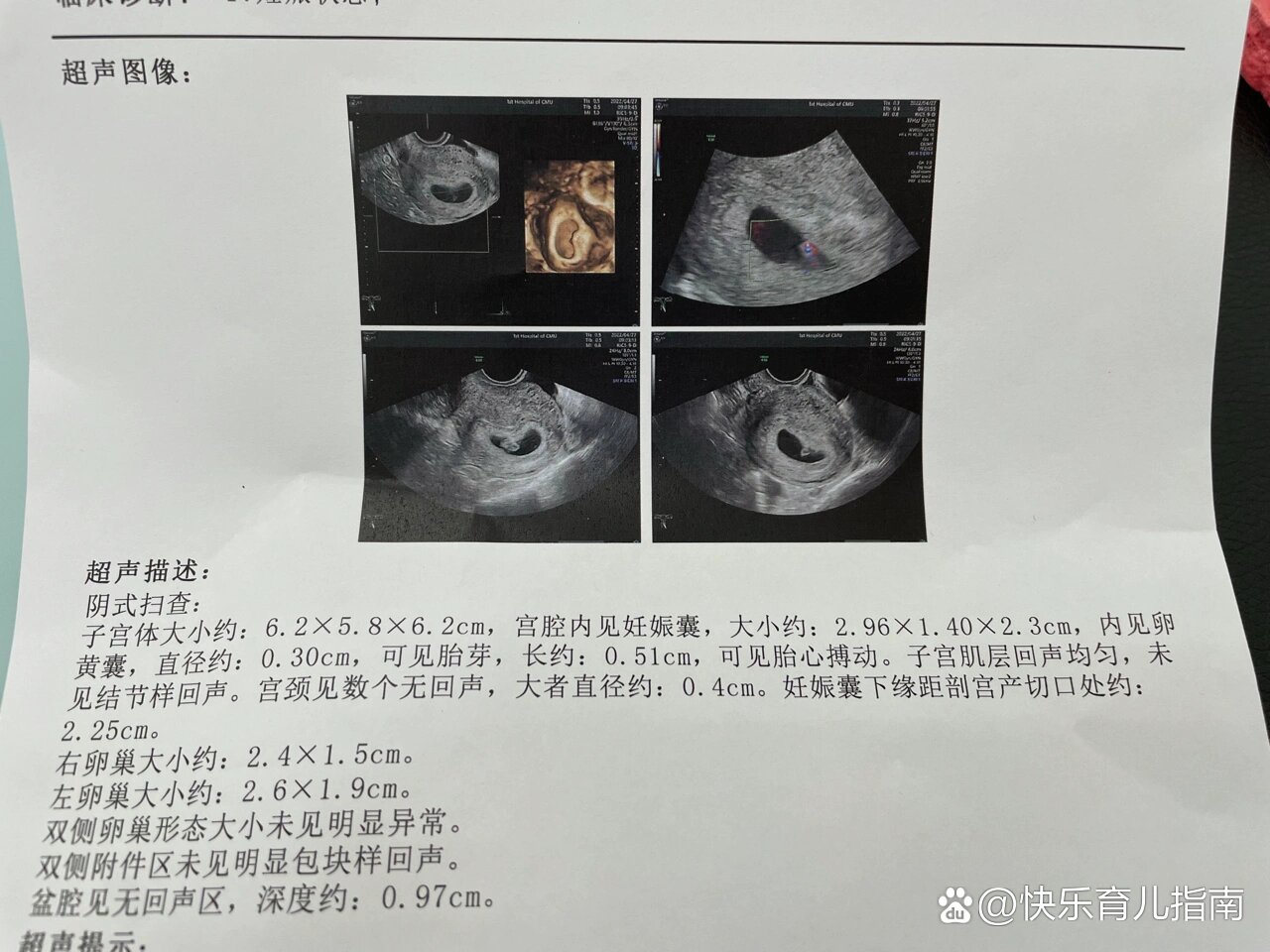 怀孕7周男孩孕囊图图片