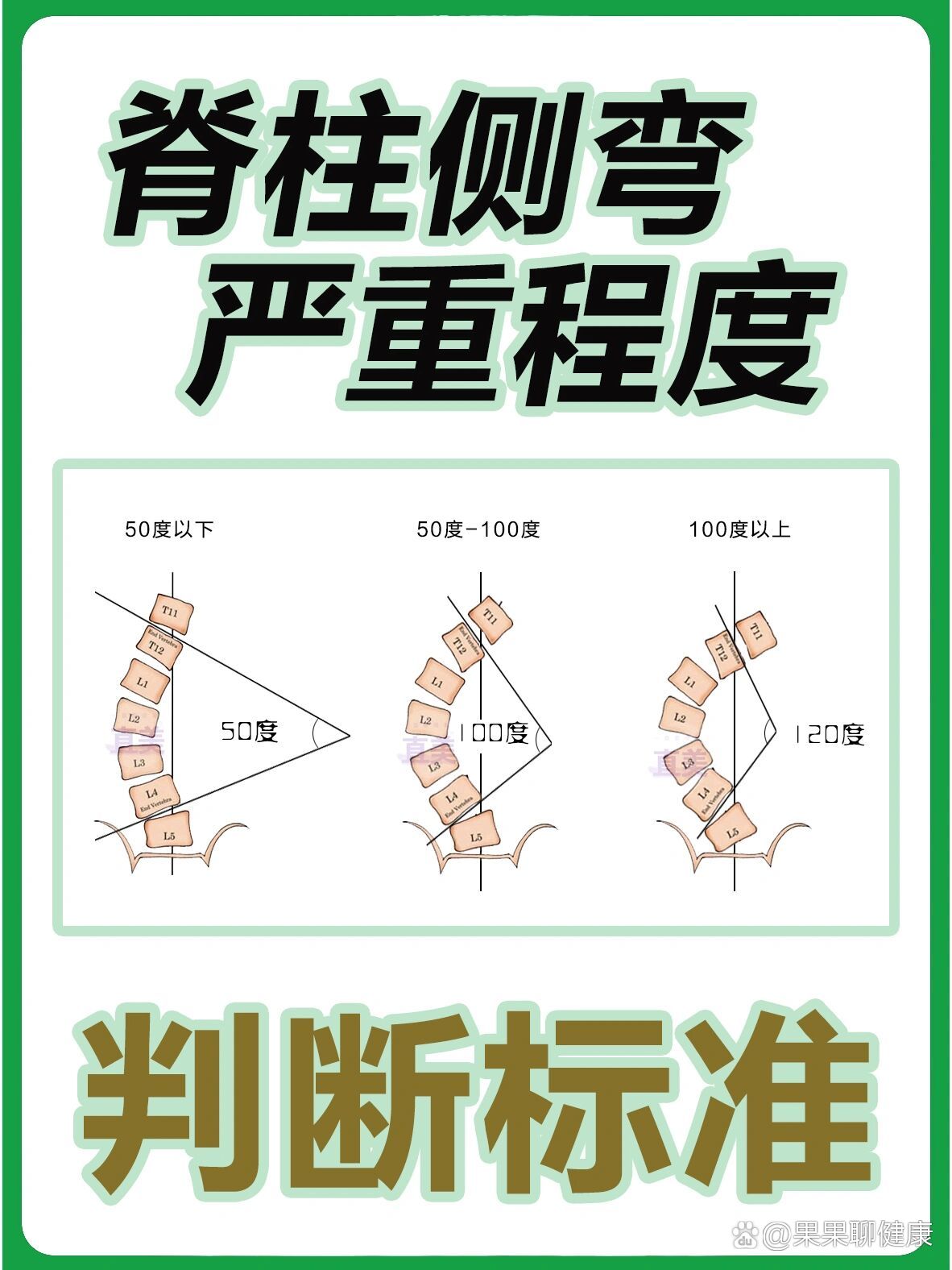 脊柱侧弯怎么看出来图片