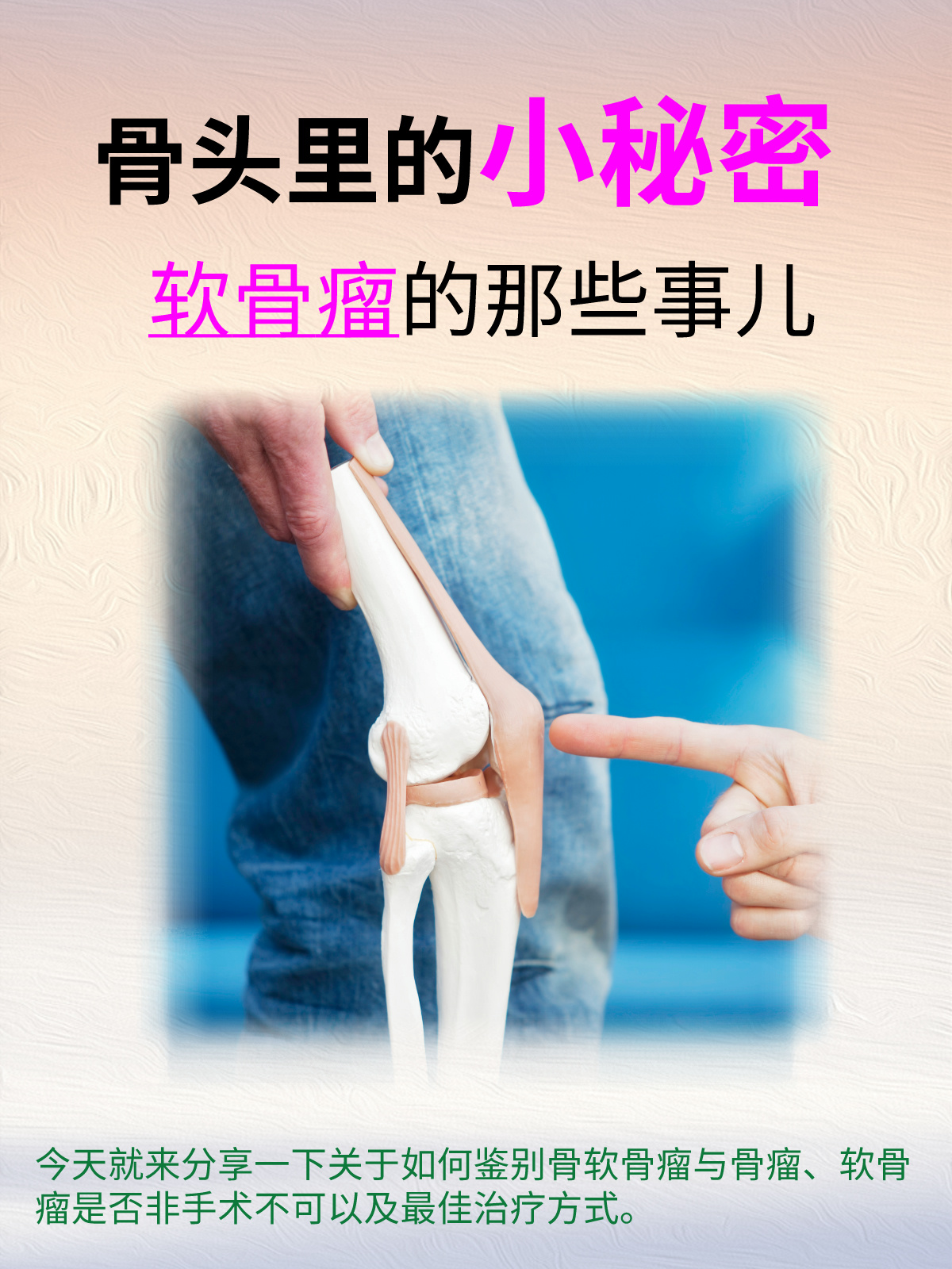 今天就来分享一下关于如何鉴别骨软骨瘤与骨瘤,软骨