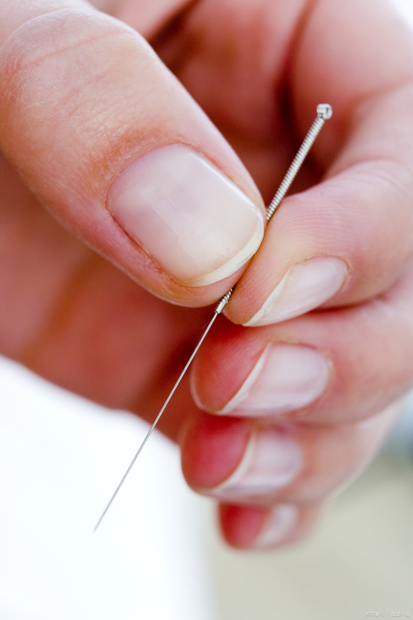 失语症是语言障碍综合征,严重影响生活