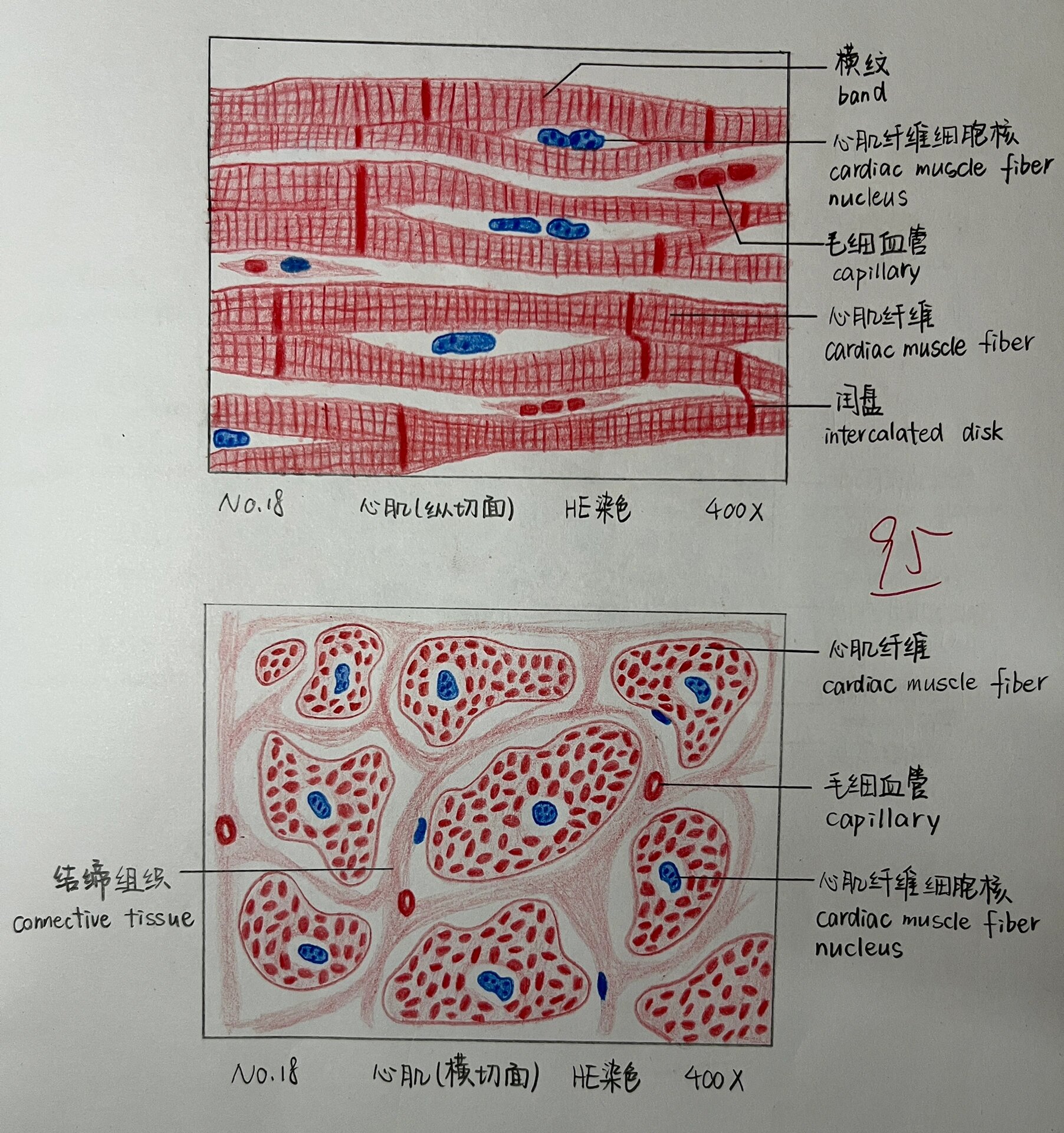 心肌纵切图图片