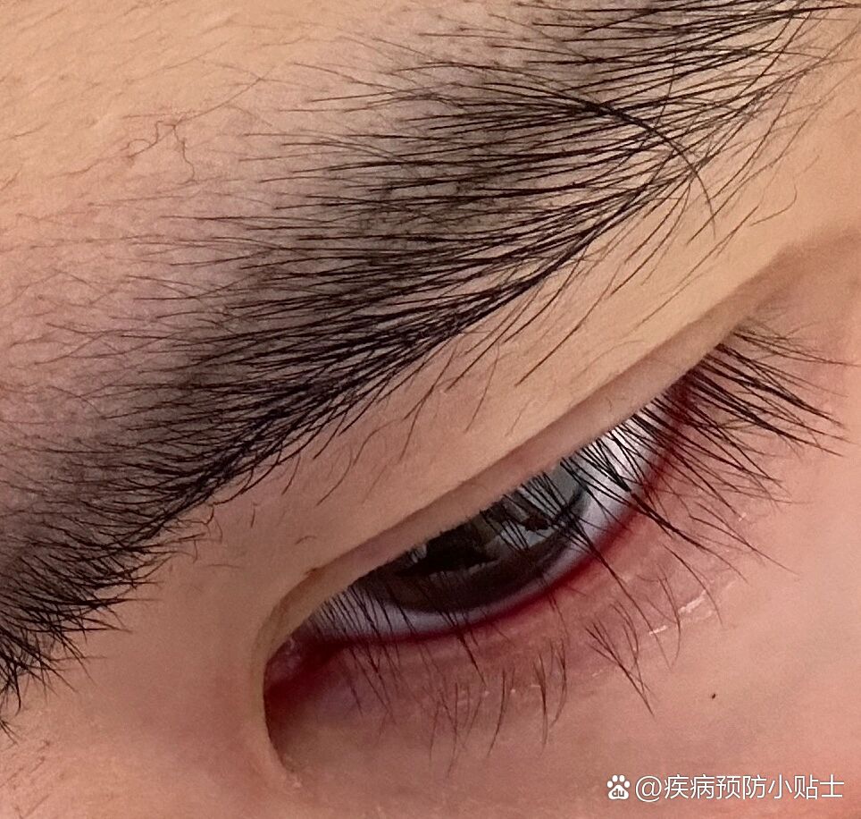 什么叫眼睛哭红了🤔