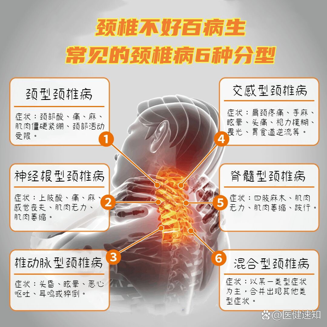 73一图看懂:颈椎病分型及各型代表性症状