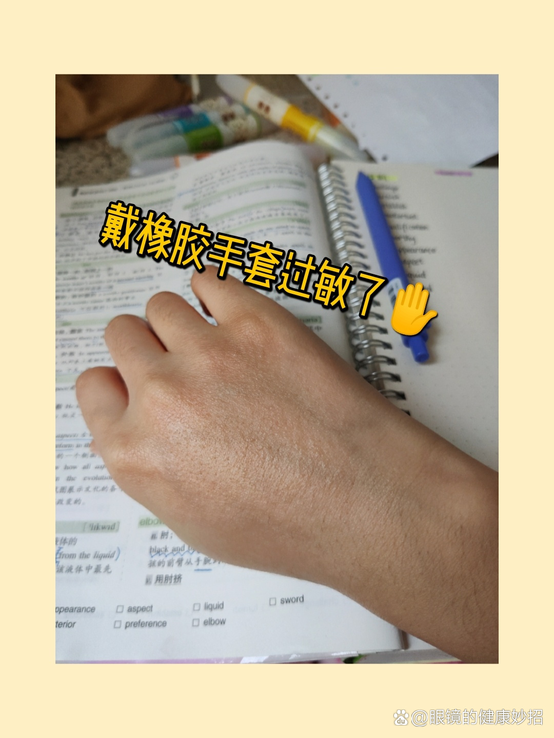 橡胶手套滑石粉过敏