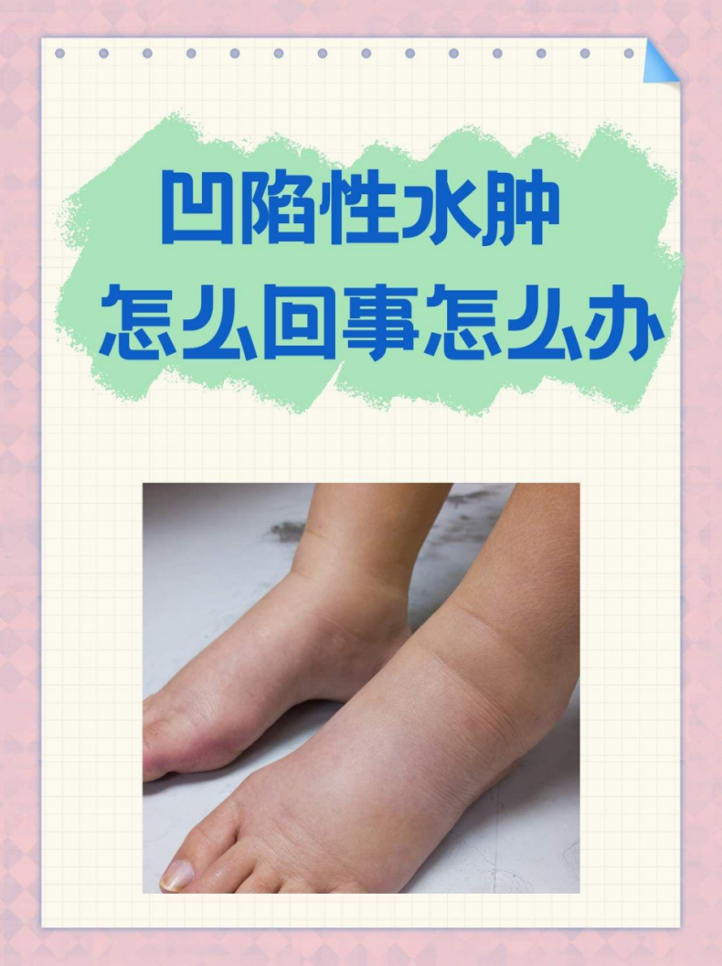 凹陷性水肿怎么回事怎么办