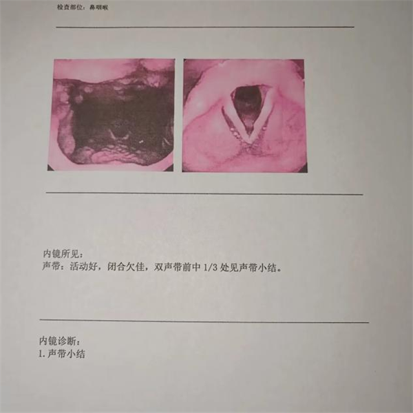 患儿声带小结不要慌,定期复查是关键