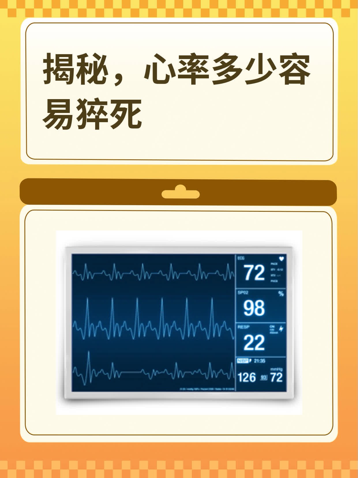揭秘心率多少容易猝死