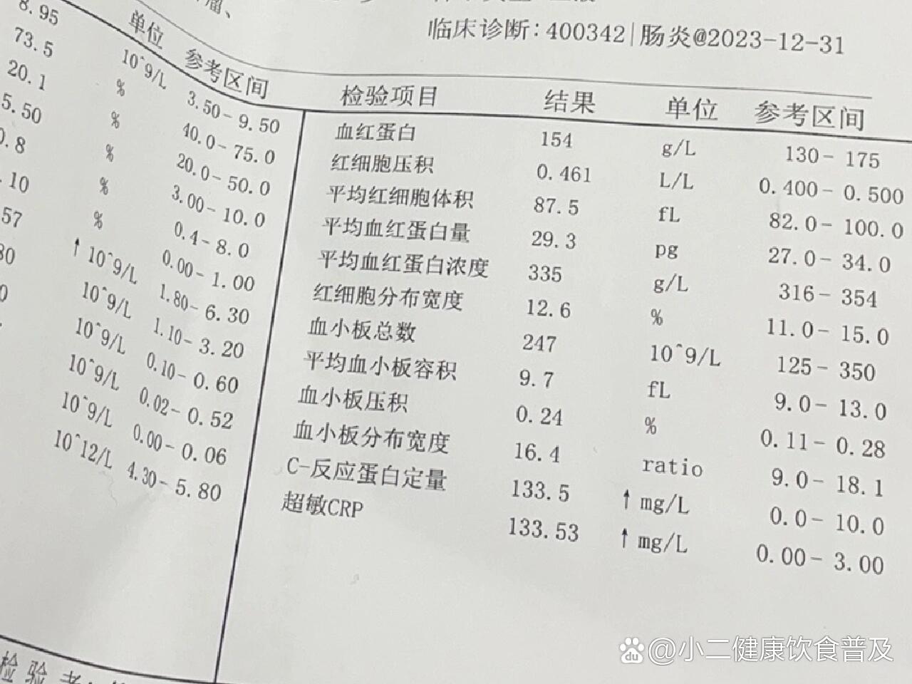 回盲部憩室炎图片