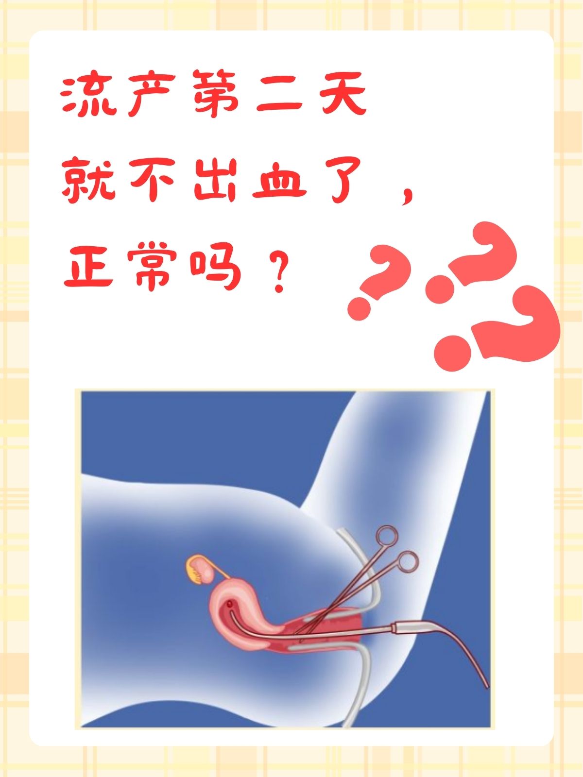流产了需要超度孩子吗-流产的孩子能埋入祖坟吗
