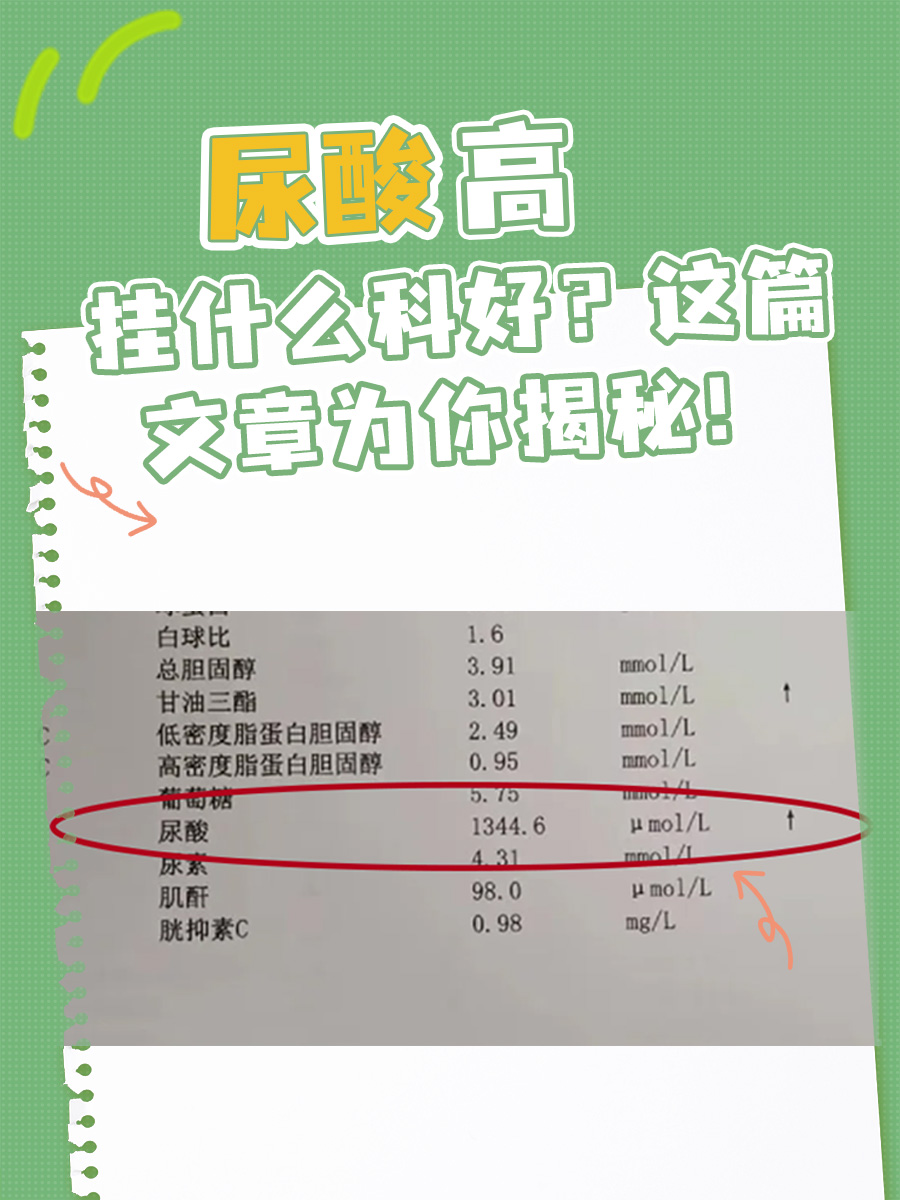 尿酸高挂什么科好?这篇文章为你揭秘!