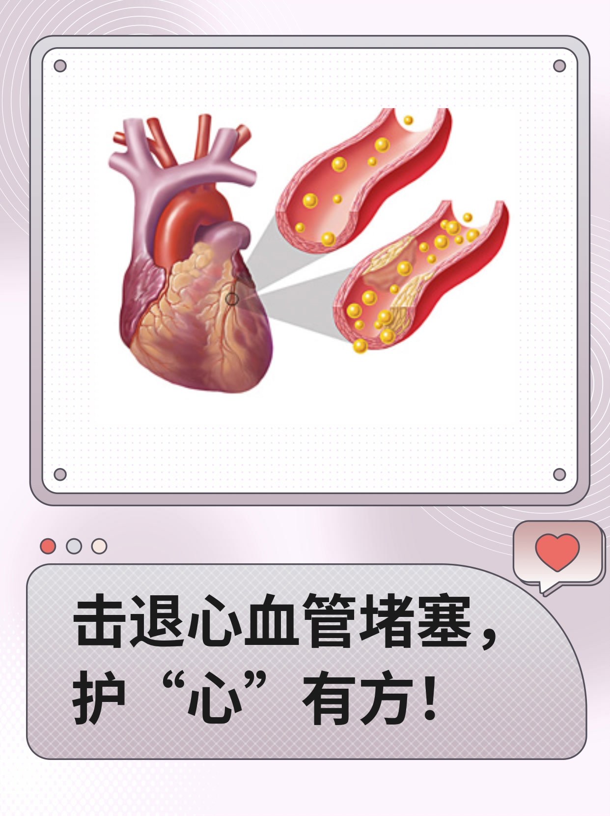 心血管堵塞疏通方法