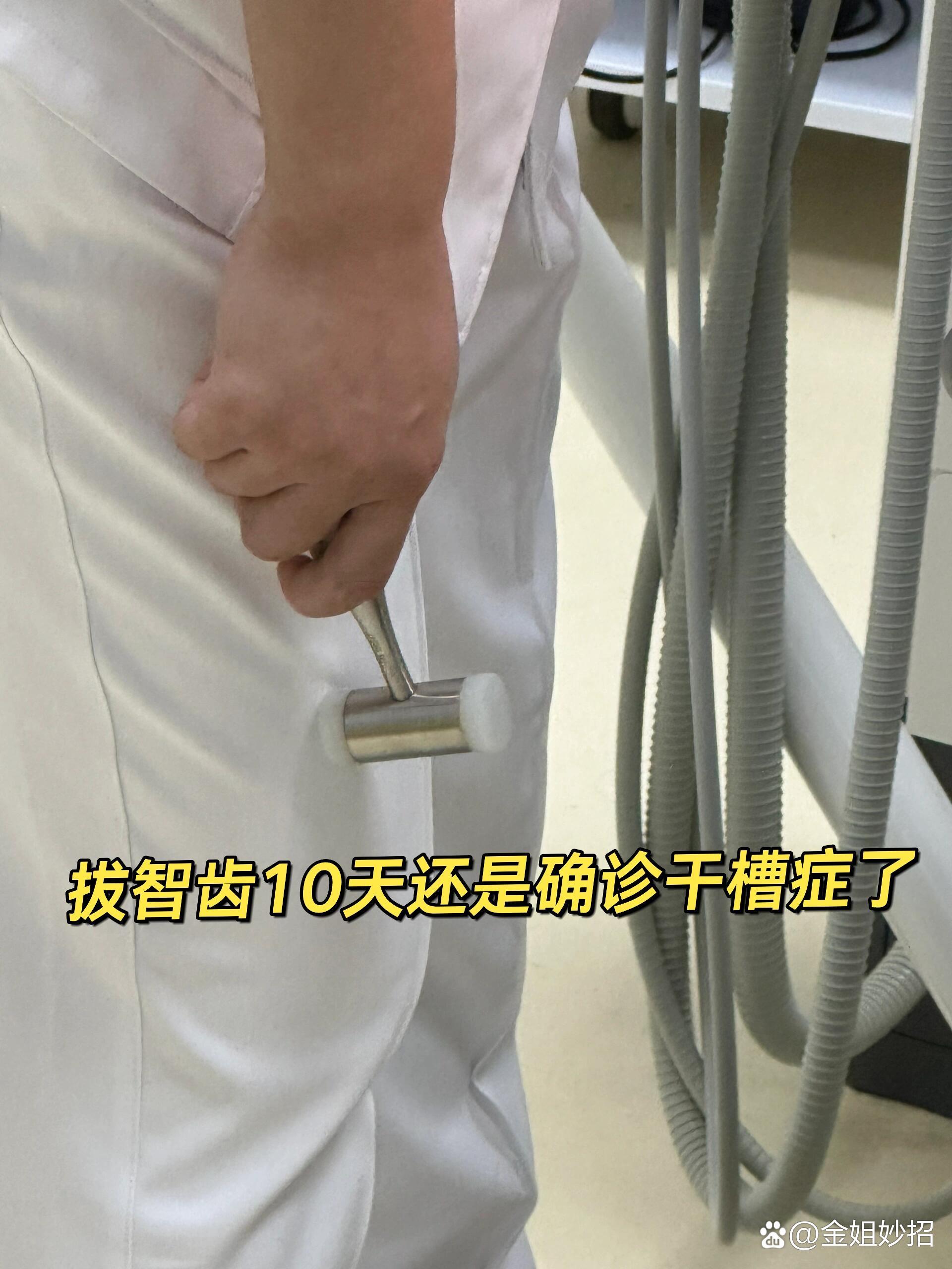 拔智齿10天还是确诊干槽症了