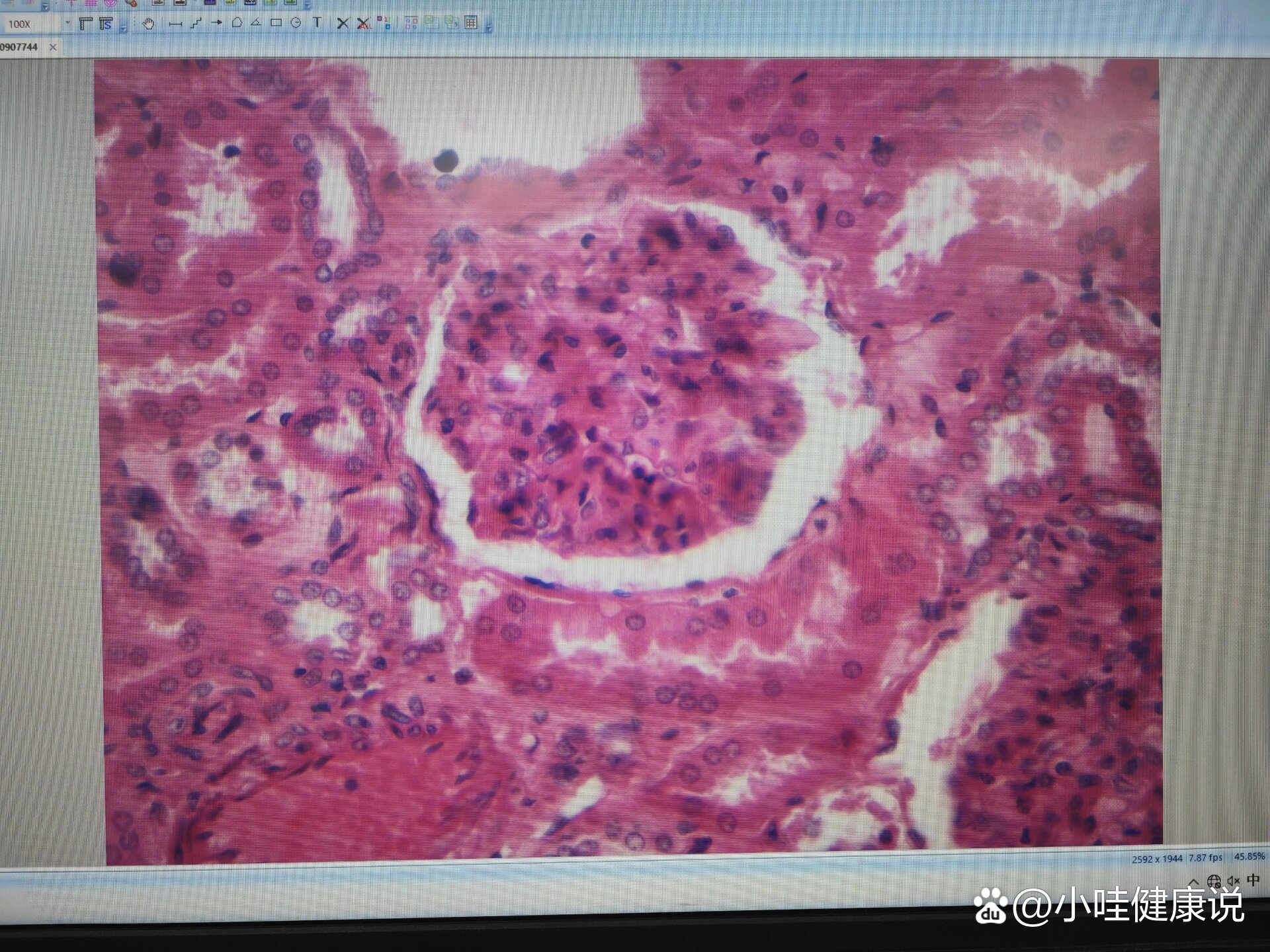 肾小体光镜图图片