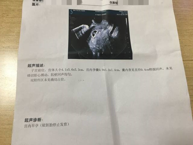 人工流产术终止妊娠,成功解决胎停育问题