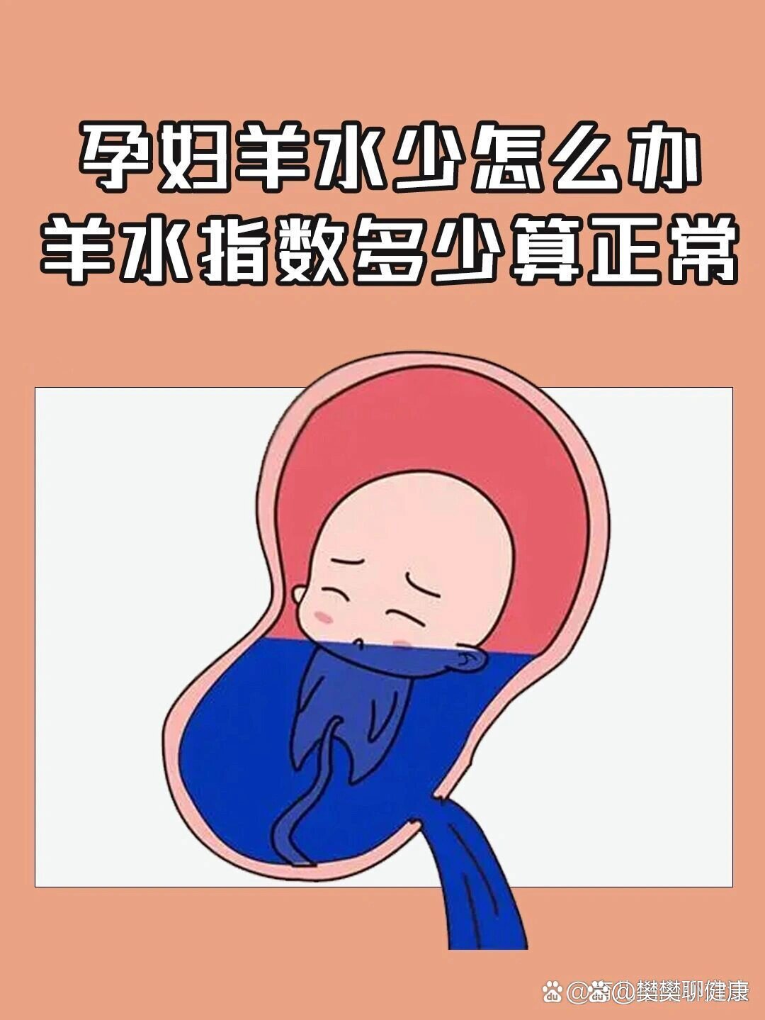 羊水少图片