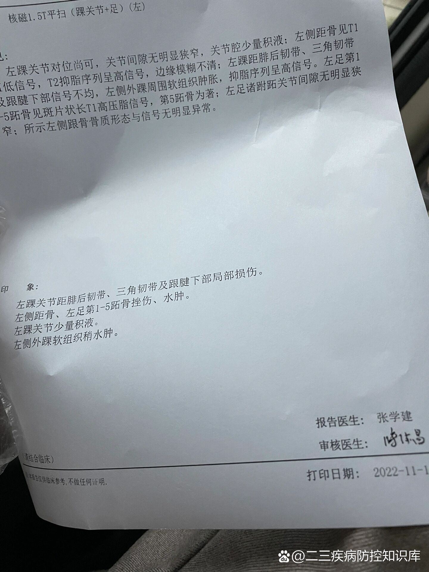 骨挫伤,骨髓水肿,韧带损伤