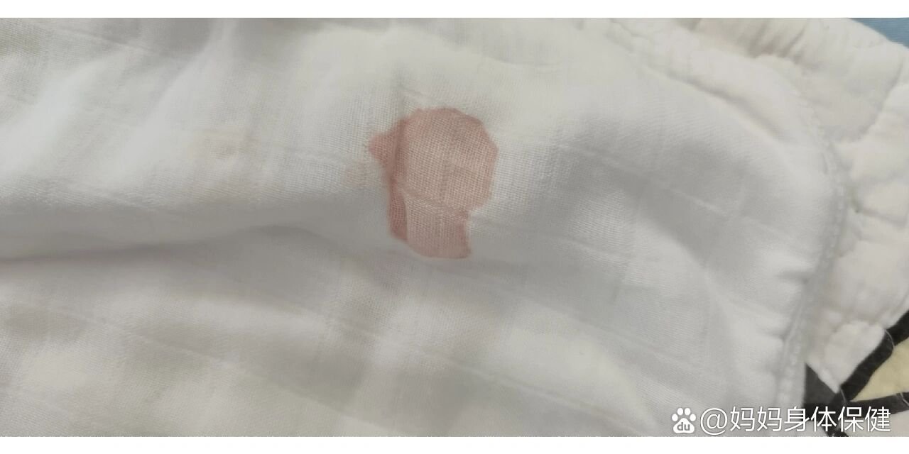 关于宝宝吐奶有血,新手爸妈注意了