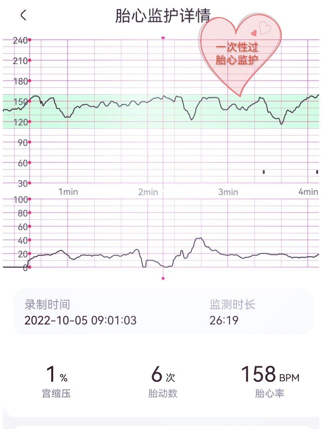 测胎心在什么位置图片