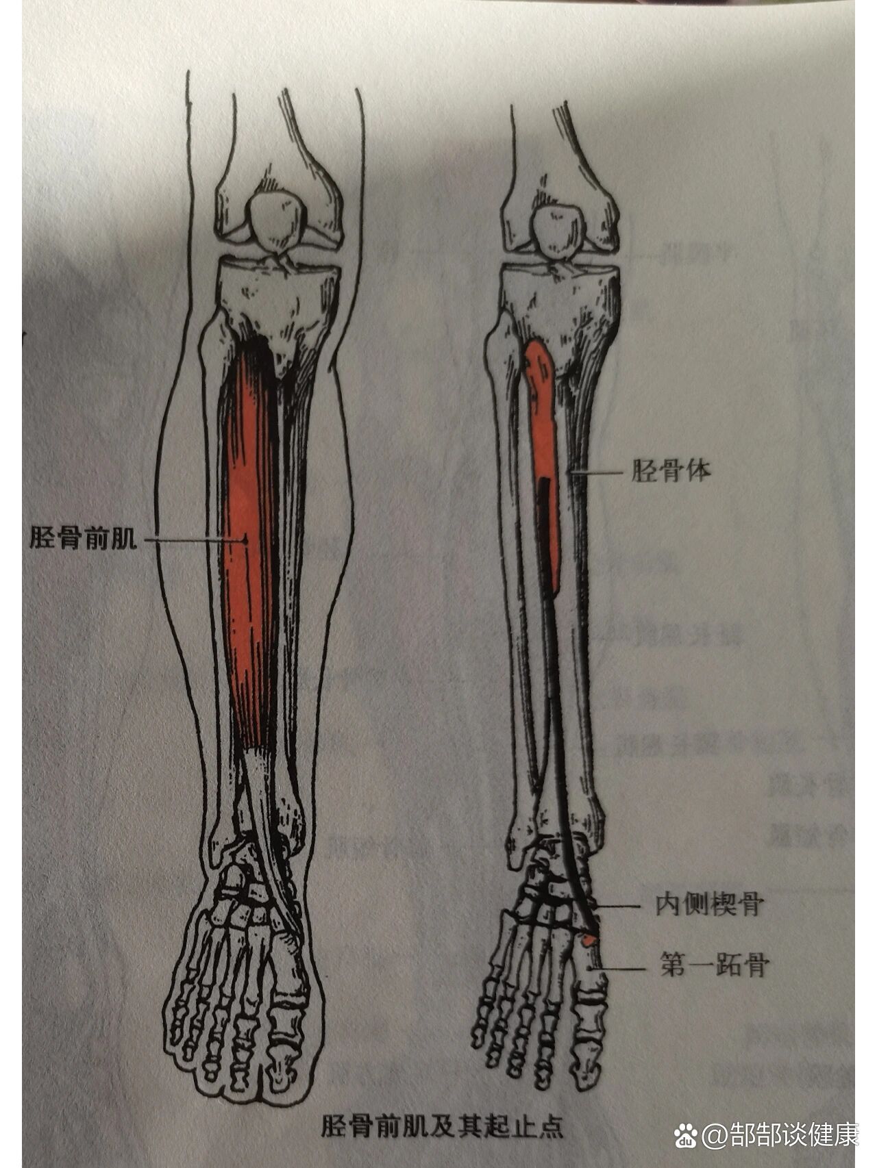 拇长屈肌腱位置图图片